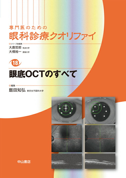 眼底ＯＣＴのすべて   /中山書店/飯田知弘（単行本） 楽天ブックス: 眼底OCTのすべて - 飯田 知弘 - 9784521734767 : 本
