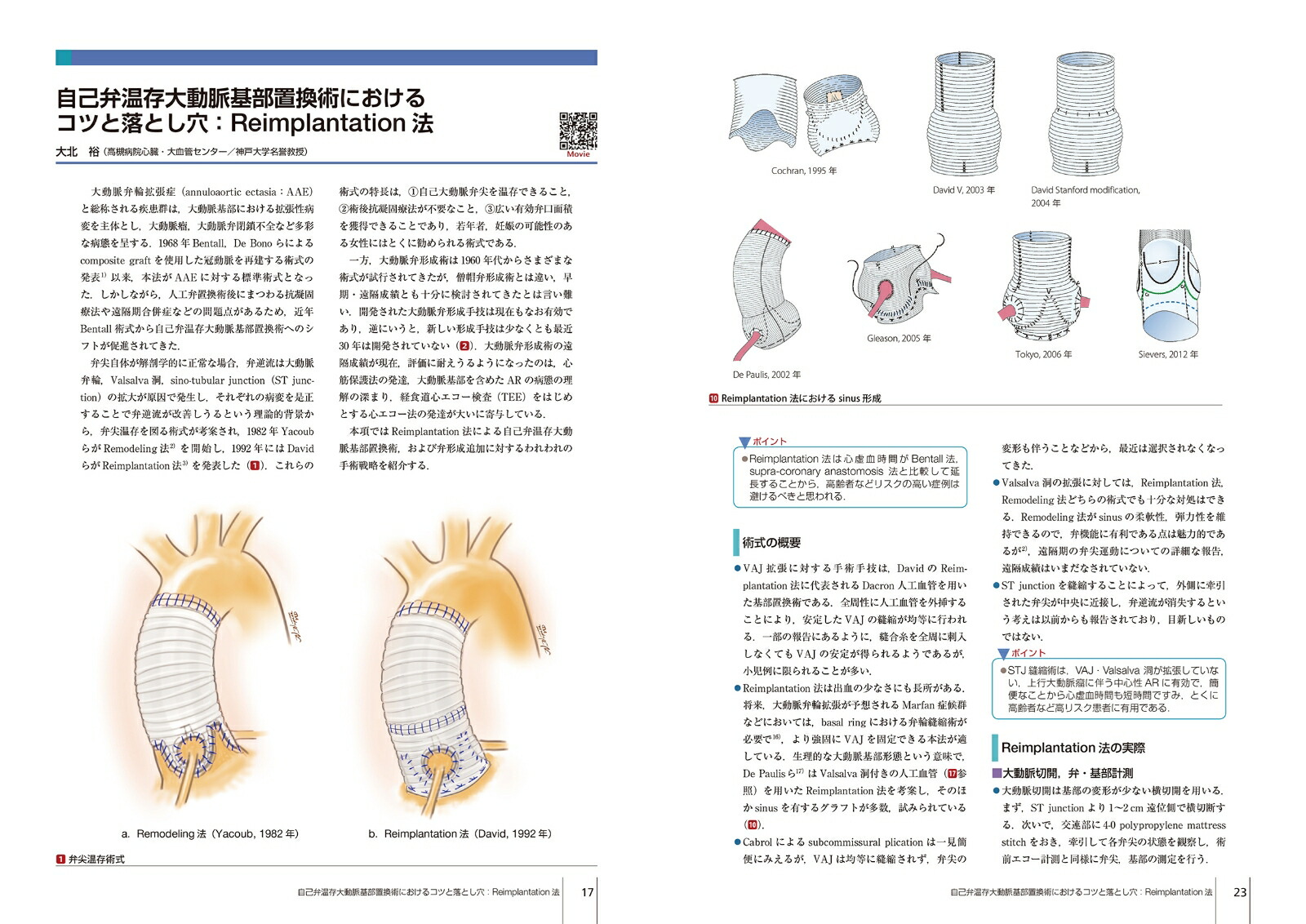 公式の 大動脈疾患の手術 第4巻 心臓血管外科手術エクセレンス 国内配送 Www Jsht Or Jp