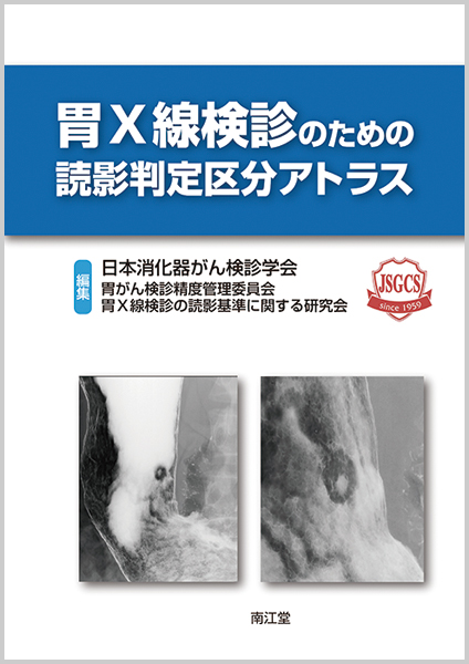 楽天ブックス: 胃X線検診のための読影判定区分アトラス - 日本消化器が