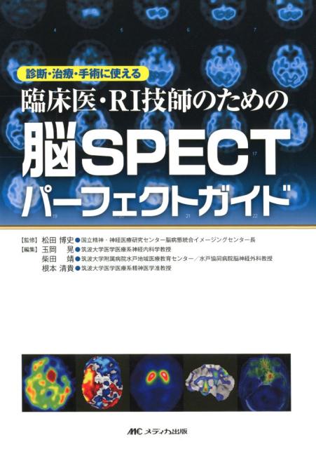 楽天ブックス: 臨床医・RI技師のための 脳SPECTパーフェクト