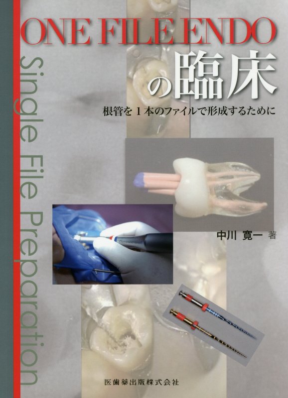 ONE FILE ENDOの臨床 根管を1本のファイルで形成するために/医歯