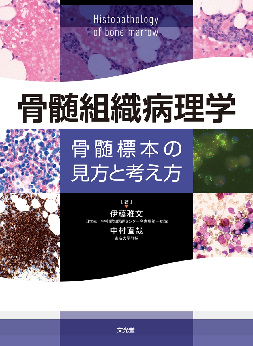 楽天ブックス: 骨髄組織病理学 骨髄標本の見方と考え方 - 伊藤 雅文