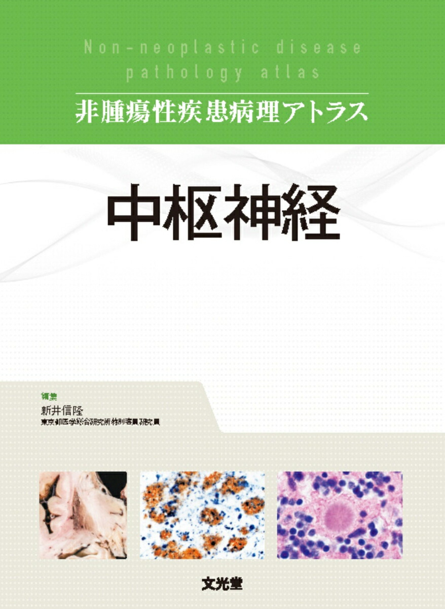 【裁断済み】　非腫瘍性疾患病理アトラス　腎 71TXXgGshGL.jpg_BO30,255,255,