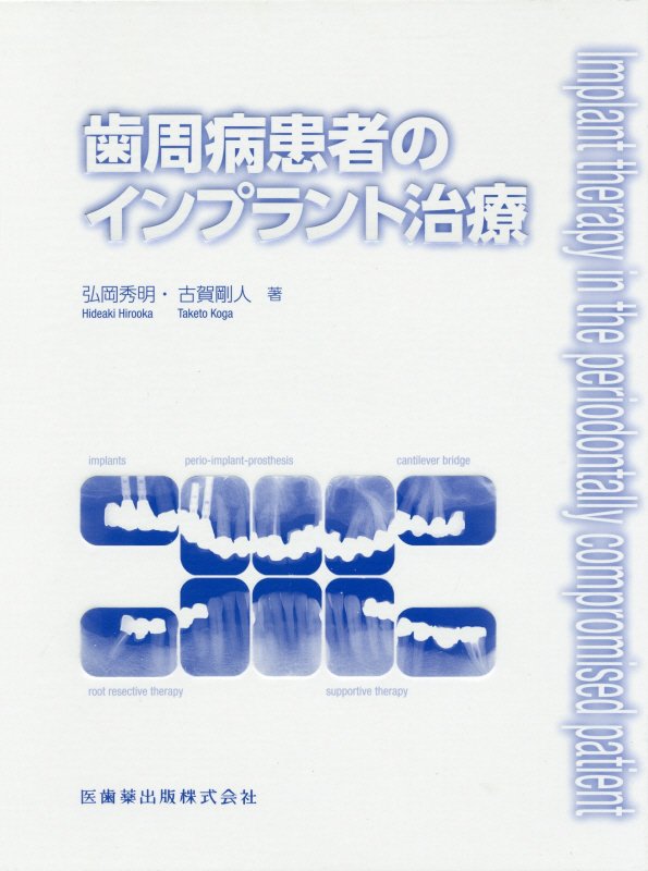 楽天ブックス: 歯周病患者のインプラント治療 - 弘岡秀明 