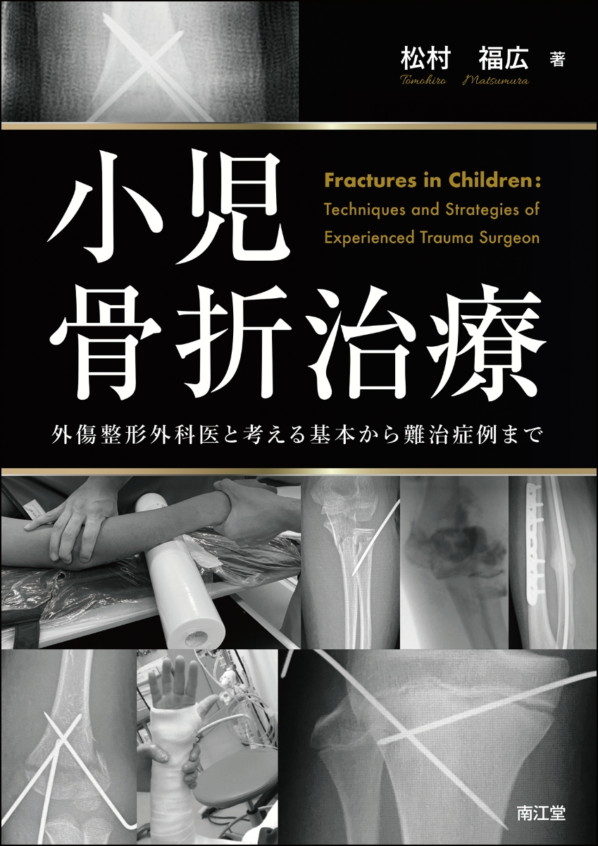 楽天ブックス: 小児骨折治療 - 外傷整形外科医と考える基本から難治
