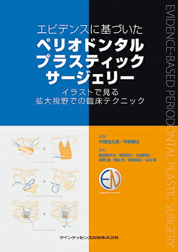 取寄品】【取寄時、納期1～3週間】3Dイラストで見るペリオドンタル