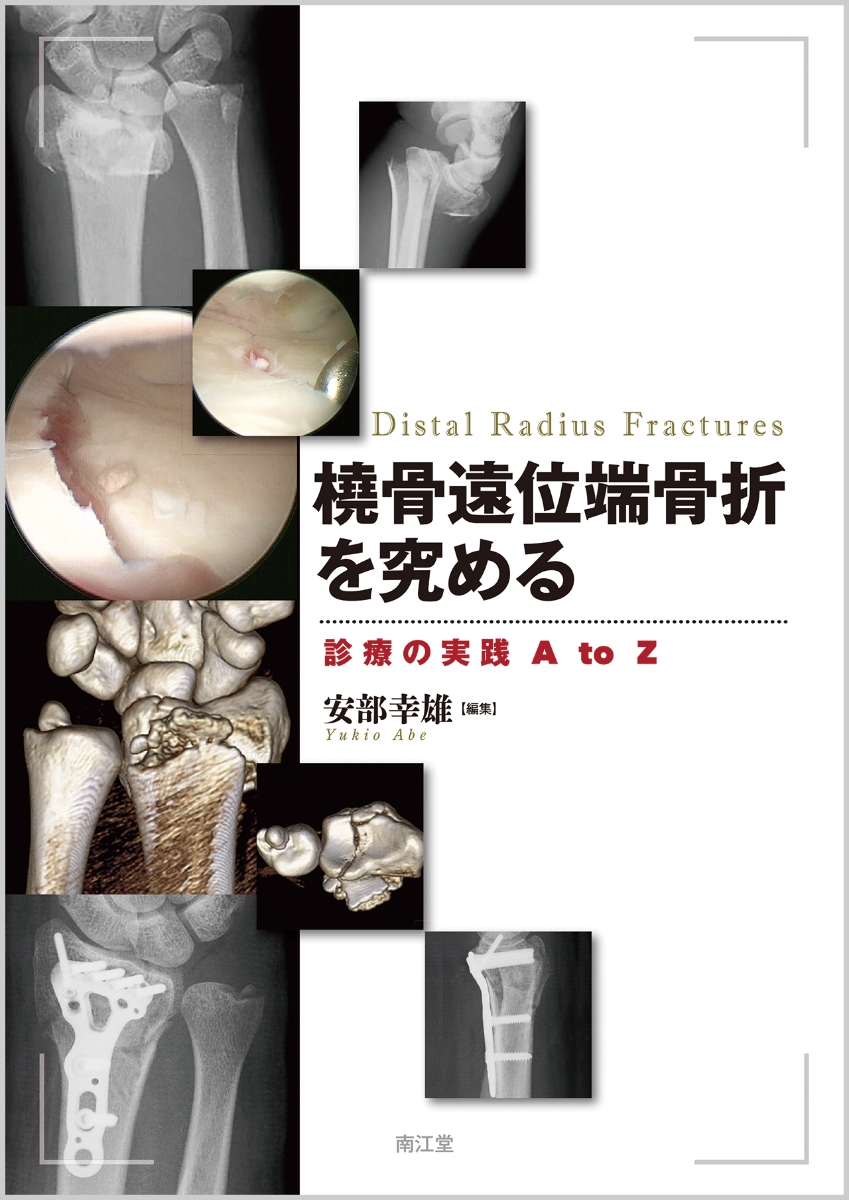 楽天ブックス: 橈骨遠位端骨折を究める - 診療の実践 A to Z - 安部