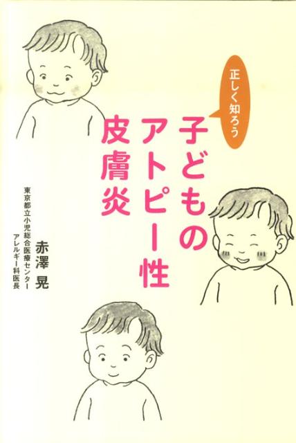 楽天ブックス 子どものアトピー性皮膚炎 正しく知ろう 赤澤晃 本