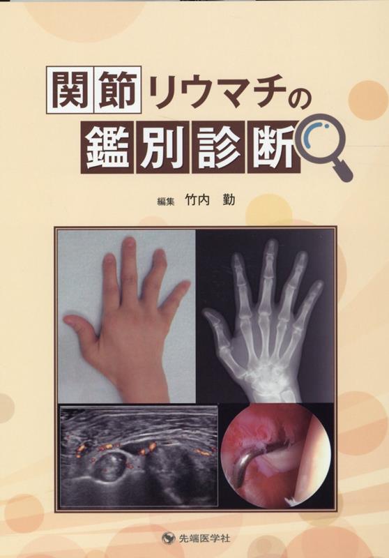楽天ブックス: 関節リウマチの鑑別診断 - 竹内勤