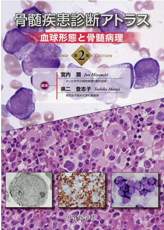 楽天ブックス: 骨髄疾患診断アトラス第2版 - 血球形態と骨髄病理