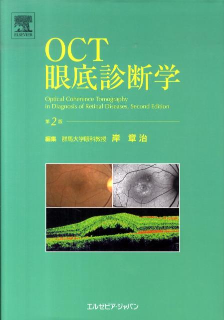 OCT アトラス 第2版 Amazon.co.jp: OCTアトラス 第2版 : 吉村 長久, 板谷 正紀, 辻川