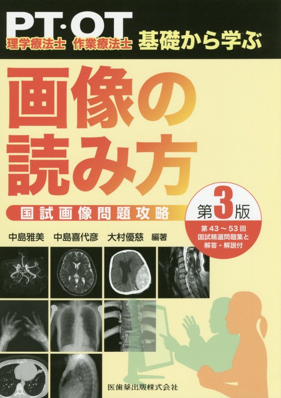 楽天ブックス 理学療法士 作業療法士pt Ot基礎から学ぶ画像の読み方国試画像問題攻略第3版 中島雅美 本