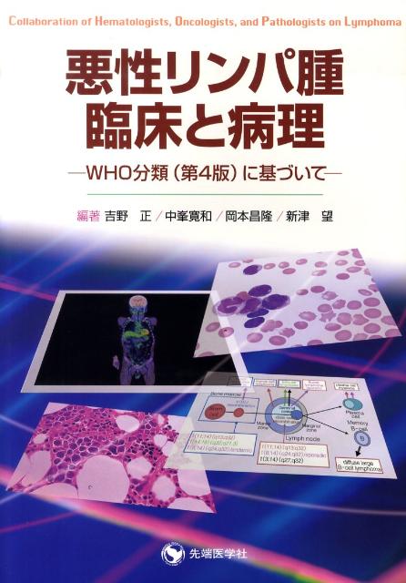 楽天ブックス: 悪性リンパ腫・臨床と病理 - WHO分類（第4版）に