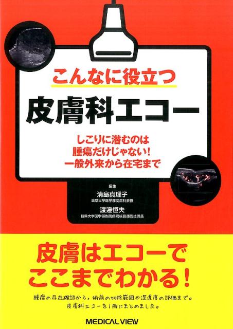 楽天ブックス: こんなに役立つ皮膚科エコー - しこりに潜むのは腫瘍