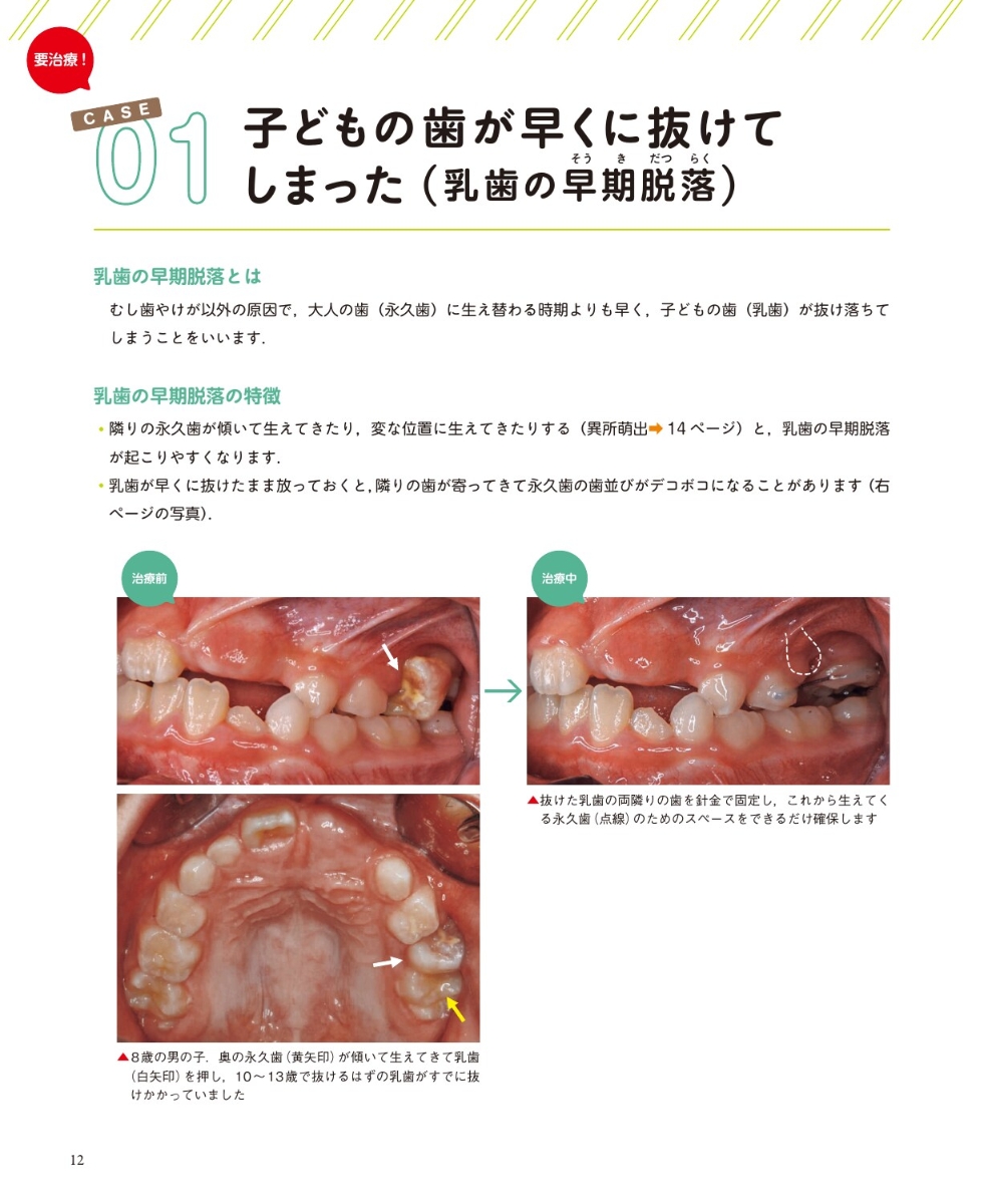 楽天ブックス 写真でわかる子どもの矯正治療ガイド お子さんの口の中 こうなっていませんか 石川基 本