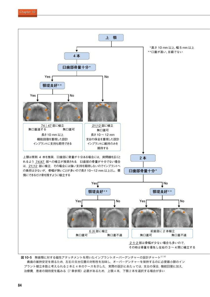 楽天ブックス 新インプラントオーバーデンチャーの基本と臨床 磁性アタッチメントを中心に 田中譲治 本