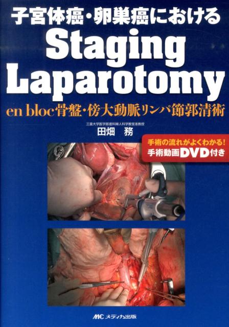 楽天ブックス: 子宮体癌・卵巣癌におけるStaging Laparotomy - en bloc