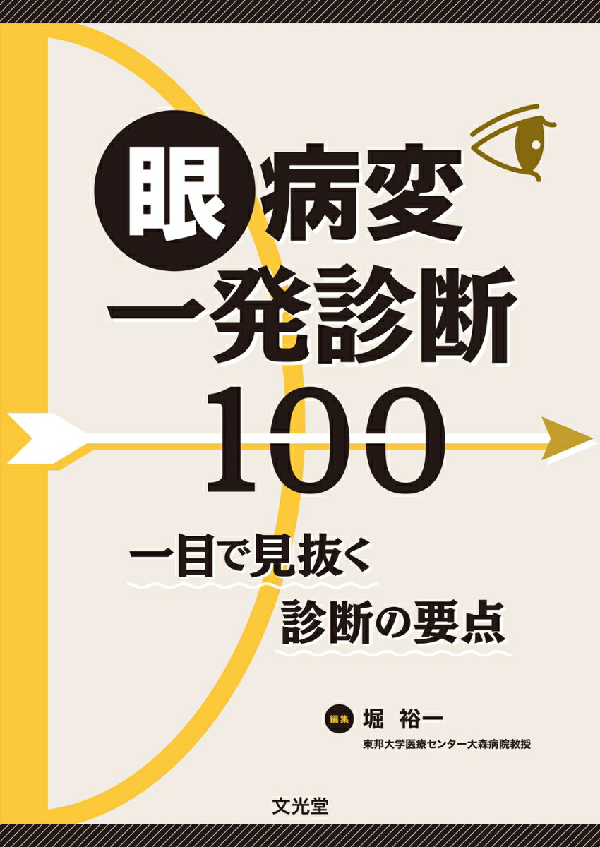 楽天ブックス: 眼病変一発診断100 - 一目で見抜く診断の要点