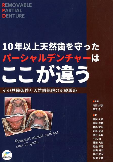 楽天ブックス: 10年以上天然歯を守ったパーシャルデンチャーはここが