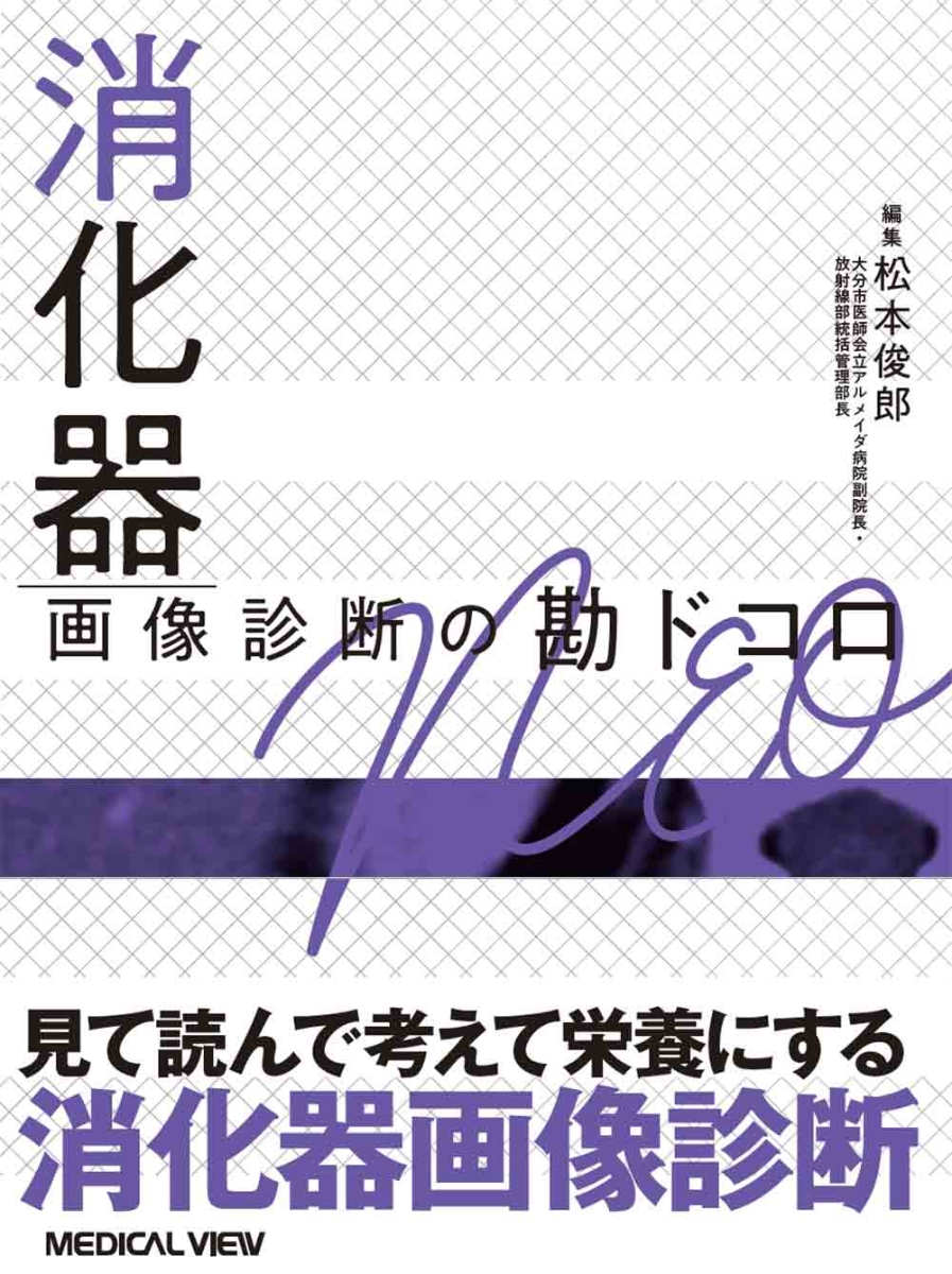 楽天ブックス: 消化器画像診断の勘ドコロNEO - 松本 俊郎