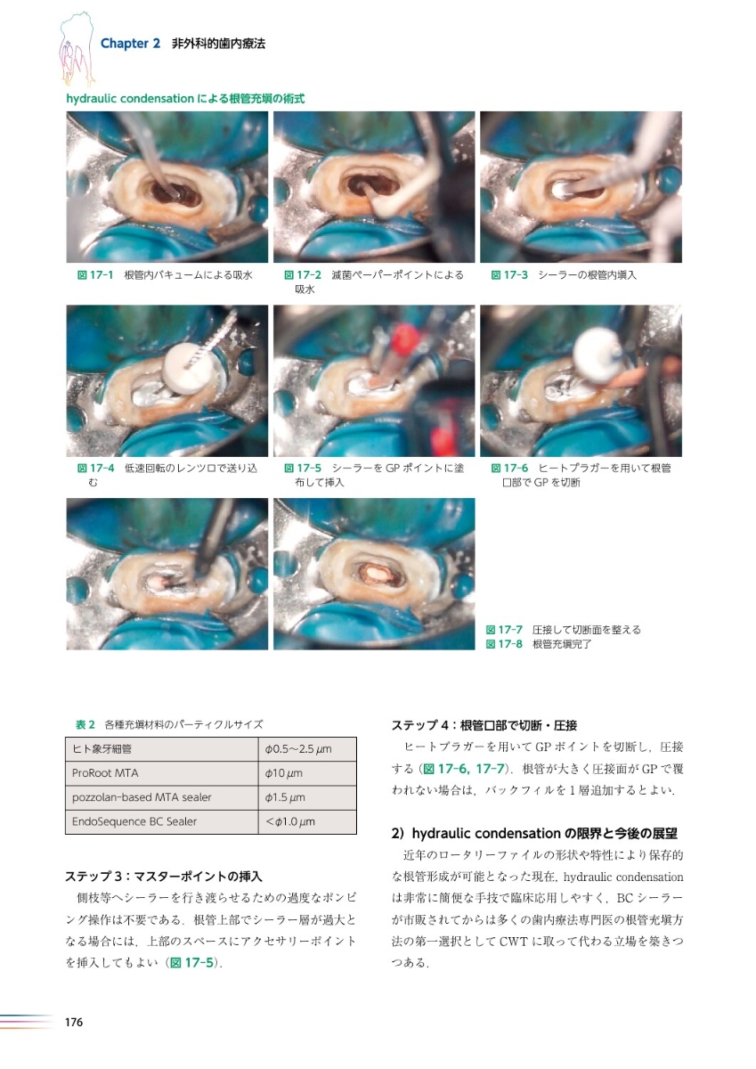 最高級のスーパー世界基準の臨床歯内療法第2版 科学・医学・技術