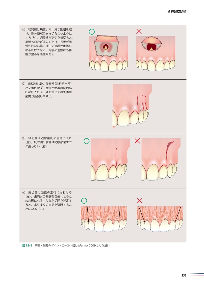 人気商品！】世界基準の臨床歯内療法第2版 科学・医学・技術 | cac