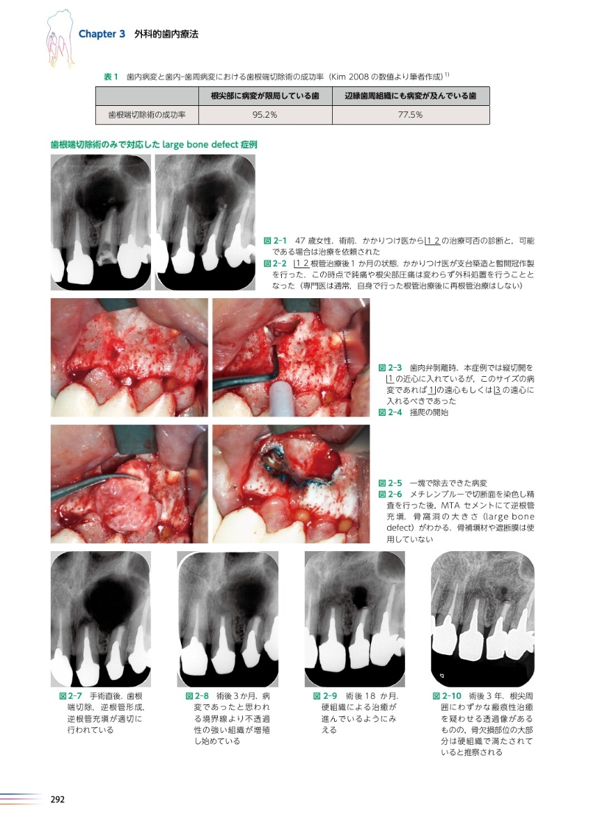 最高級のスーパー世界基準の臨床歯内療法第2版 科学・医学・技術