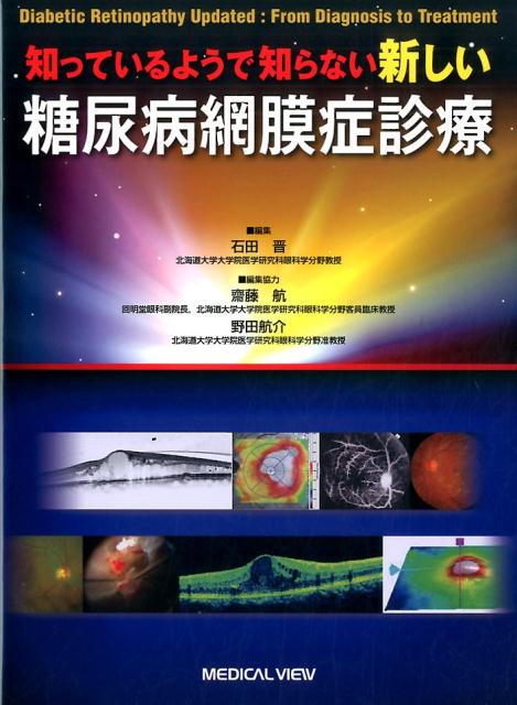 知っているようで知らない新しい糖尿病網膜症診療-