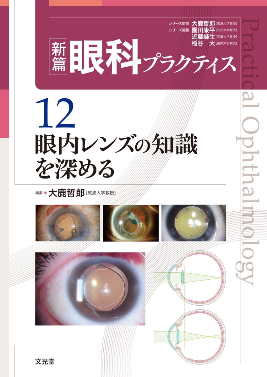 購入公式サイト 神経眼科はじめの一歩 (新篇眼科プラクティス 10) - 本