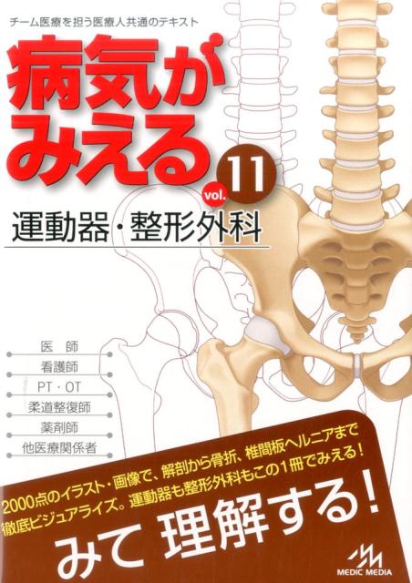 楽天ブックス: 病気がみえる（vol.11） - 運動器・整形外科 - 医療情報