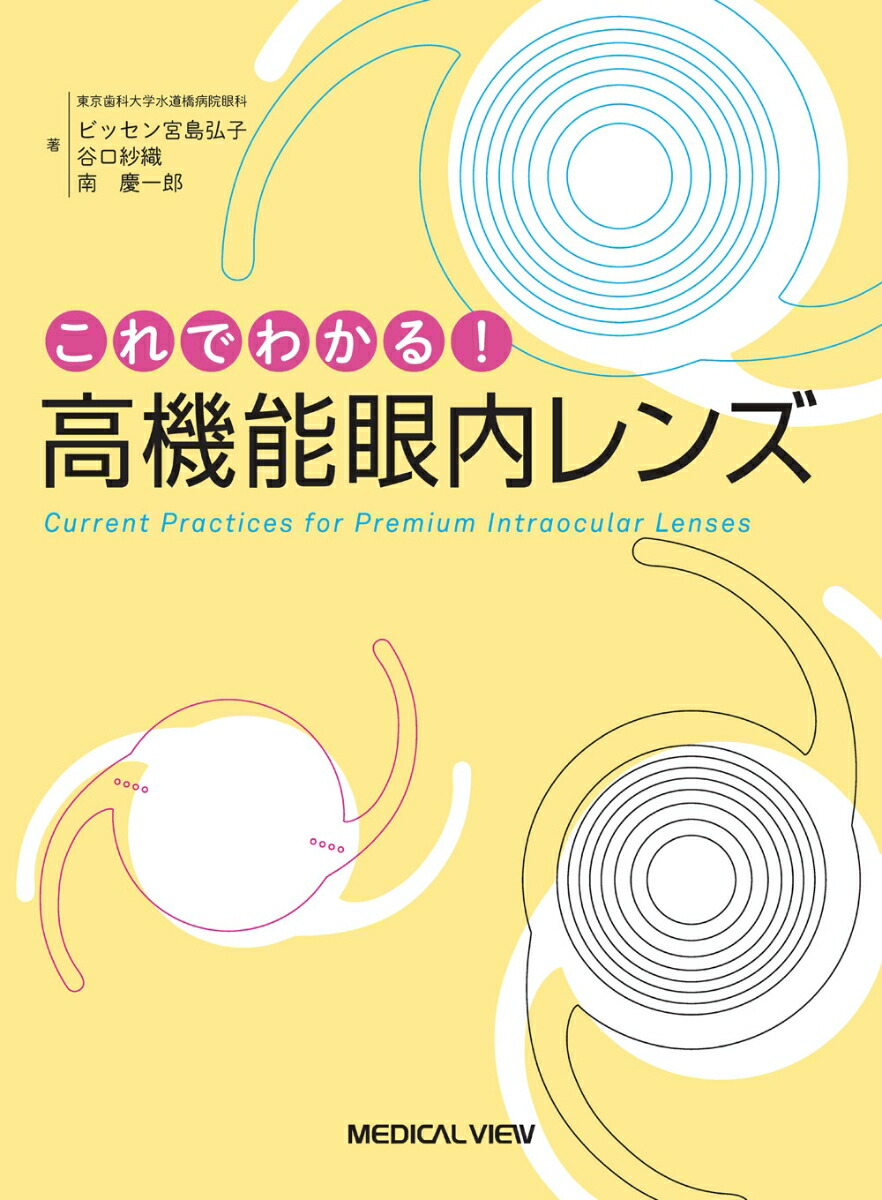 楽天ブックス: これでわかる！ 高機能眼内レンズ - ビッセン宮島 弘子