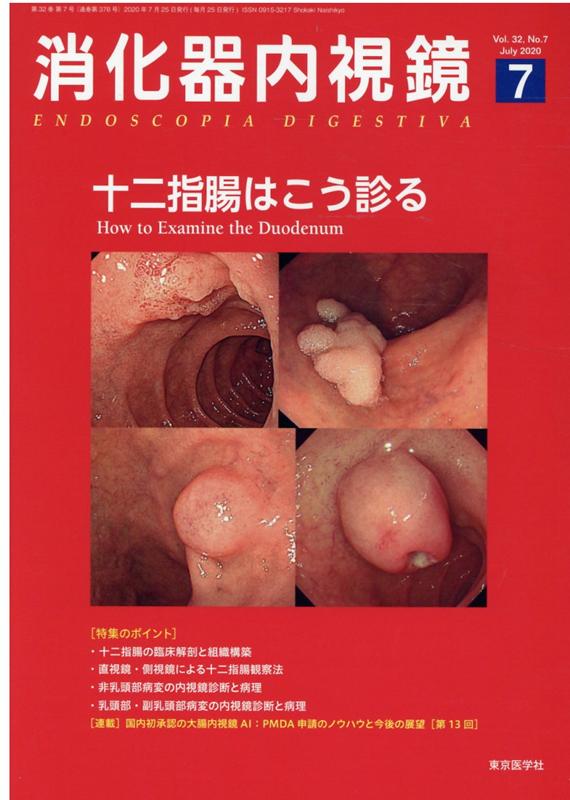 楽天ブックス: 消化器内視鏡（Vol．32 No．7（202） - 消化器内視鏡