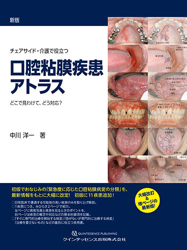 楽天ブックス: 新版 チェアサイド・介護で役立つ 口腔粘膜疾患アトラス