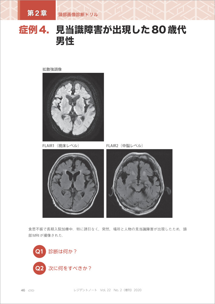 �������ǥɥ��ʥ쥸�ǥ�ȥΡ���������[��ļ�]
