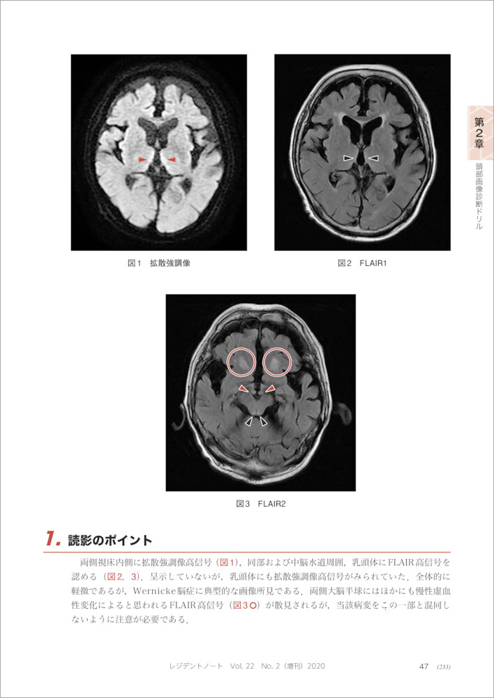 �������ǥɥ��ʥ쥸�ǥ�ȥΡ���������[��ļ�]