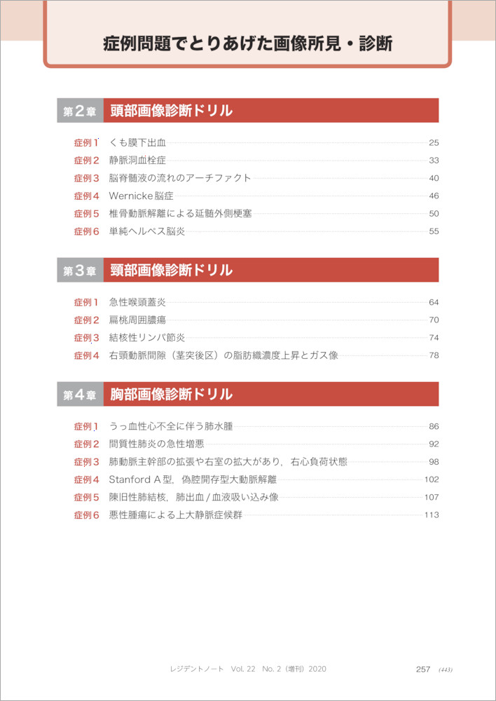 �������ǥɥ��ʥ쥸�ǥ�ȥΡ���������[��ļ�]