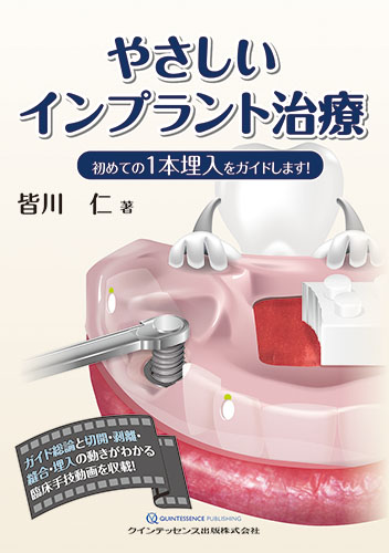 楽天ブックス: やさしいインプラント治療 - 初めての1本埋入をガイドし