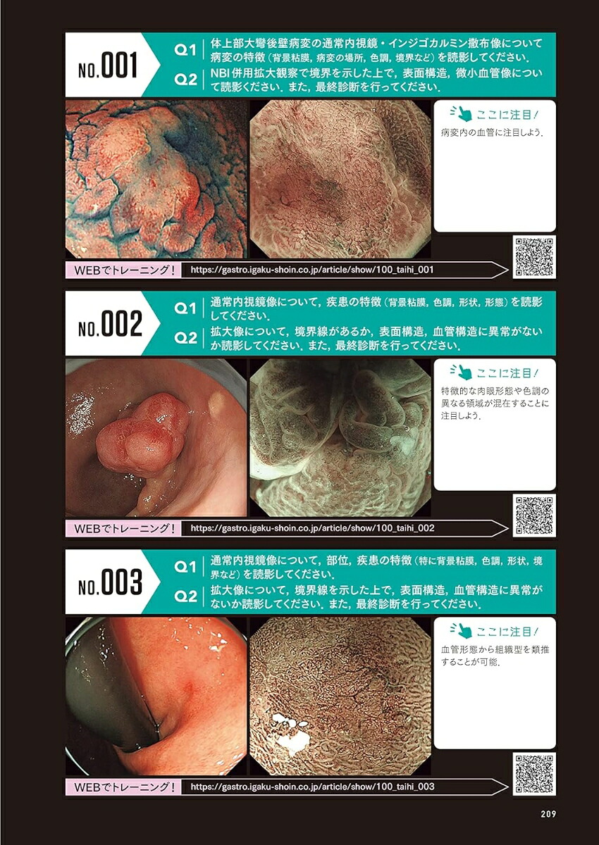 百症例式胃の拡大内視鏡×病理対比アトラス[拡大内視鏡×病理対比診断研究会アトラス作成委員会]