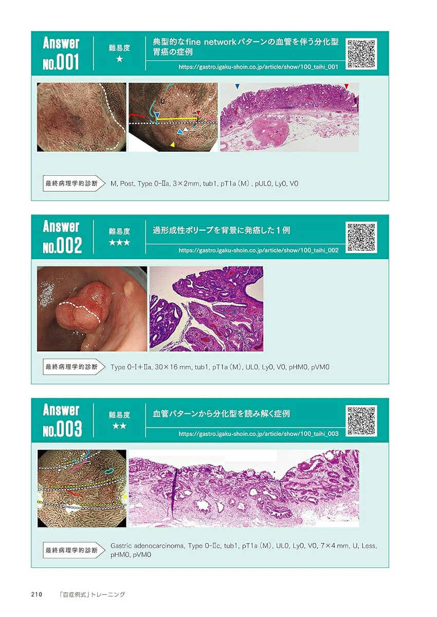 百症例式胃の拡大内視鏡×病理対比アトラス[拡大内視鏡×病理対比診断研究会アトラス作成委員会]