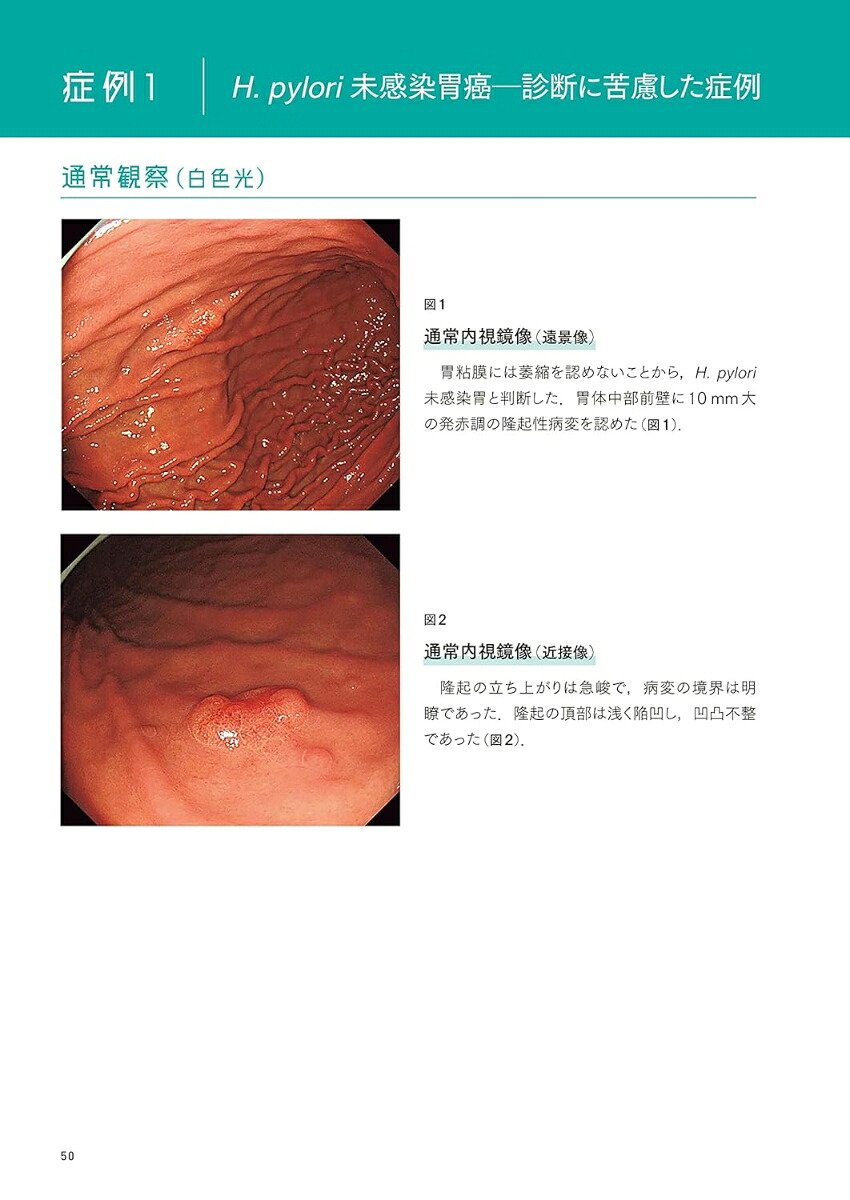 百症例式胃の拡大内視鏡×病理対比アトラス[拡大内視鏡×病理対比診断研究会アトラス作成委員会]