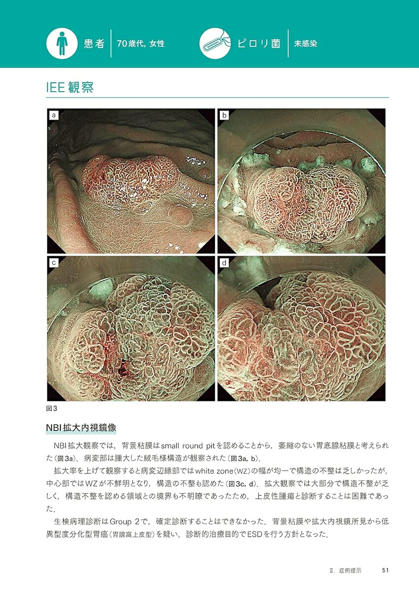百症例式胃の拡大内視鏡×病理対比アトラス[拡大内視鏡×病理対比診断研究会アトラス作成委員会]