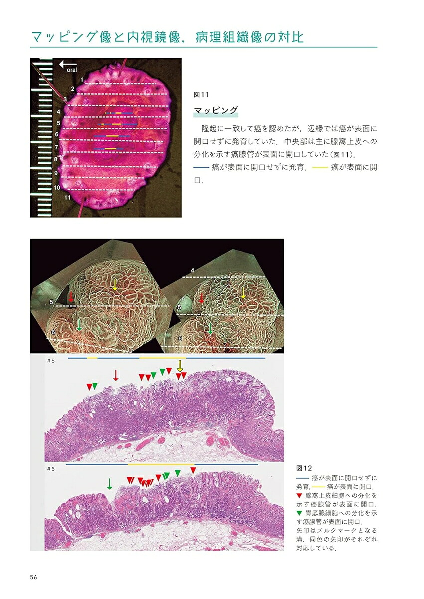 百症例式胃の拡大内視鏡×病理対比アトラス[拡大内視鏡×病理対比診断研究会アトラス作成委員会]