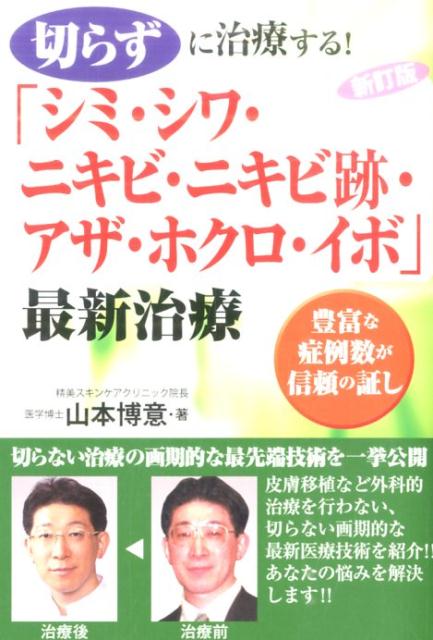 楽天ブックス: 切らずに治療する！「シミ・シワ・ニキビ・ニキビ跡