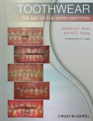 楽天ブックス: Toothwear: The ABC of the Worn Dentition - Farid