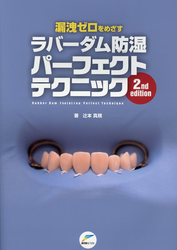 漏洩ゼロをめざすラバーダム防湿パーフェクトテクニック | 辻本