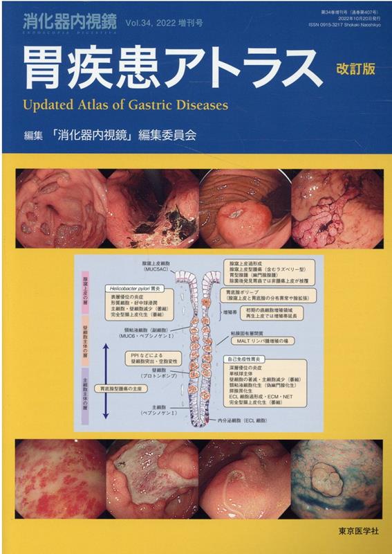 消化器内視鏡（Vol．34（2022　増刊号）改訂版　胃疾患アトラス　改訂版