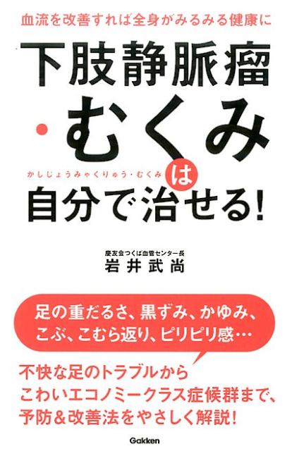 楽天ブックス 下肢静脈瘤 むくみは自分で治せる 岩井武尚 本