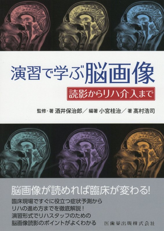 楽天ブックス 演習で学ぶ脳画像 読影からリハ介入まで 酒井保治郎 本 楽天ブックス 演習で学ぶ脳画像 読影からリハ介入まで 酒井保治郎 本