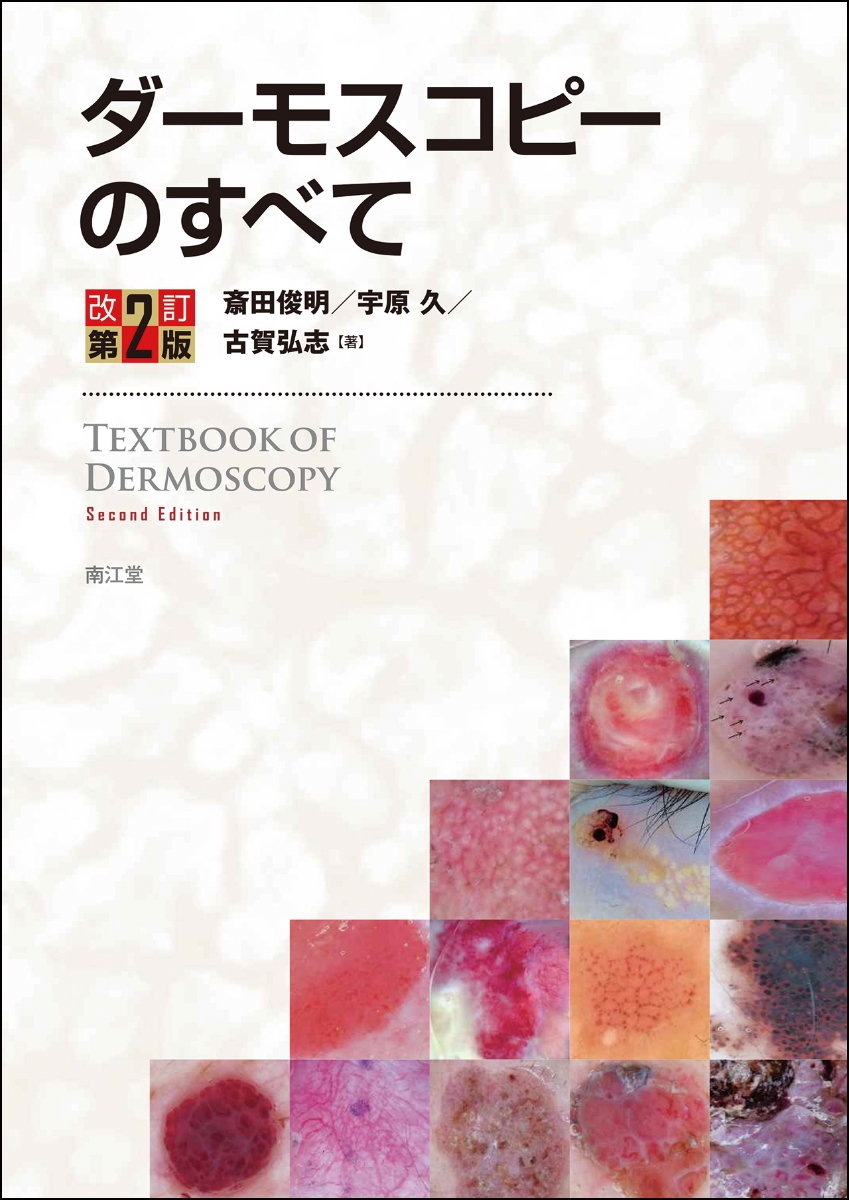 楽天ブックス: ダーモスコピーのすべて（改訂第2版） - 斎田俊明