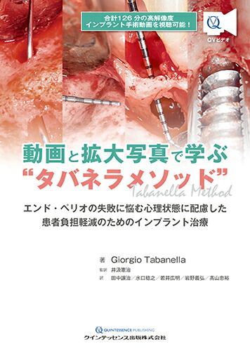 のオシャレな 動画と拡大写真で学ぶ タバネラメソッド エンド ペリオの失敗に悩む心理状態に配慮した患者負担軽減のためのインプラント治療 ポイント10倍 Khappykombucha Com